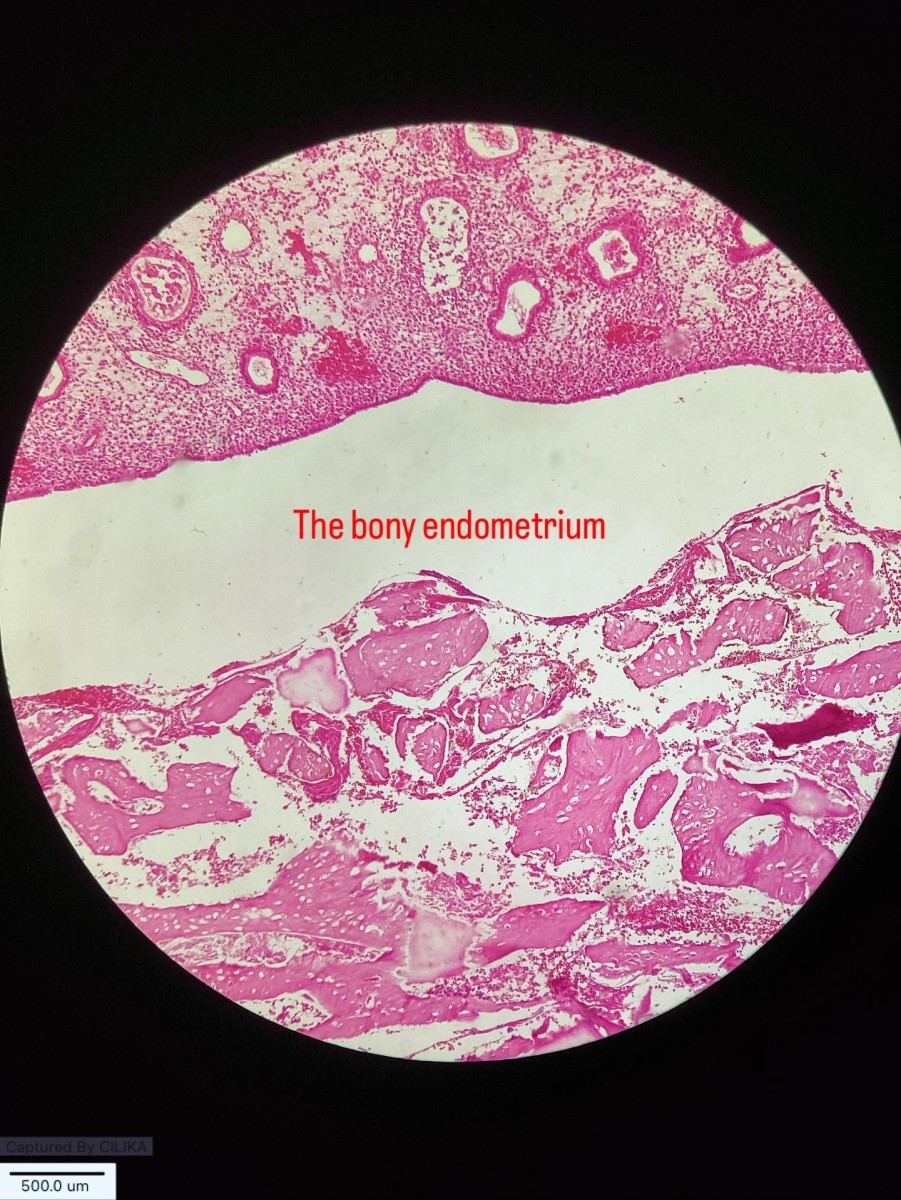 “ The Bony Endometrium - nature’s Unexpected Architecture Project “